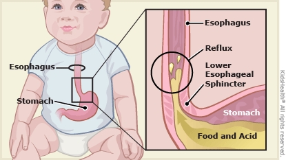 KidsHealth Image